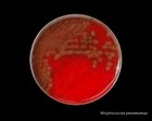 Virulent S.pneumoniae